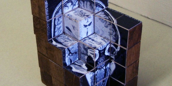 wooden_mri_scan.jpg